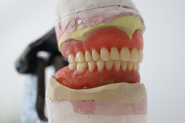 How To Make Dentures Fit More Securely